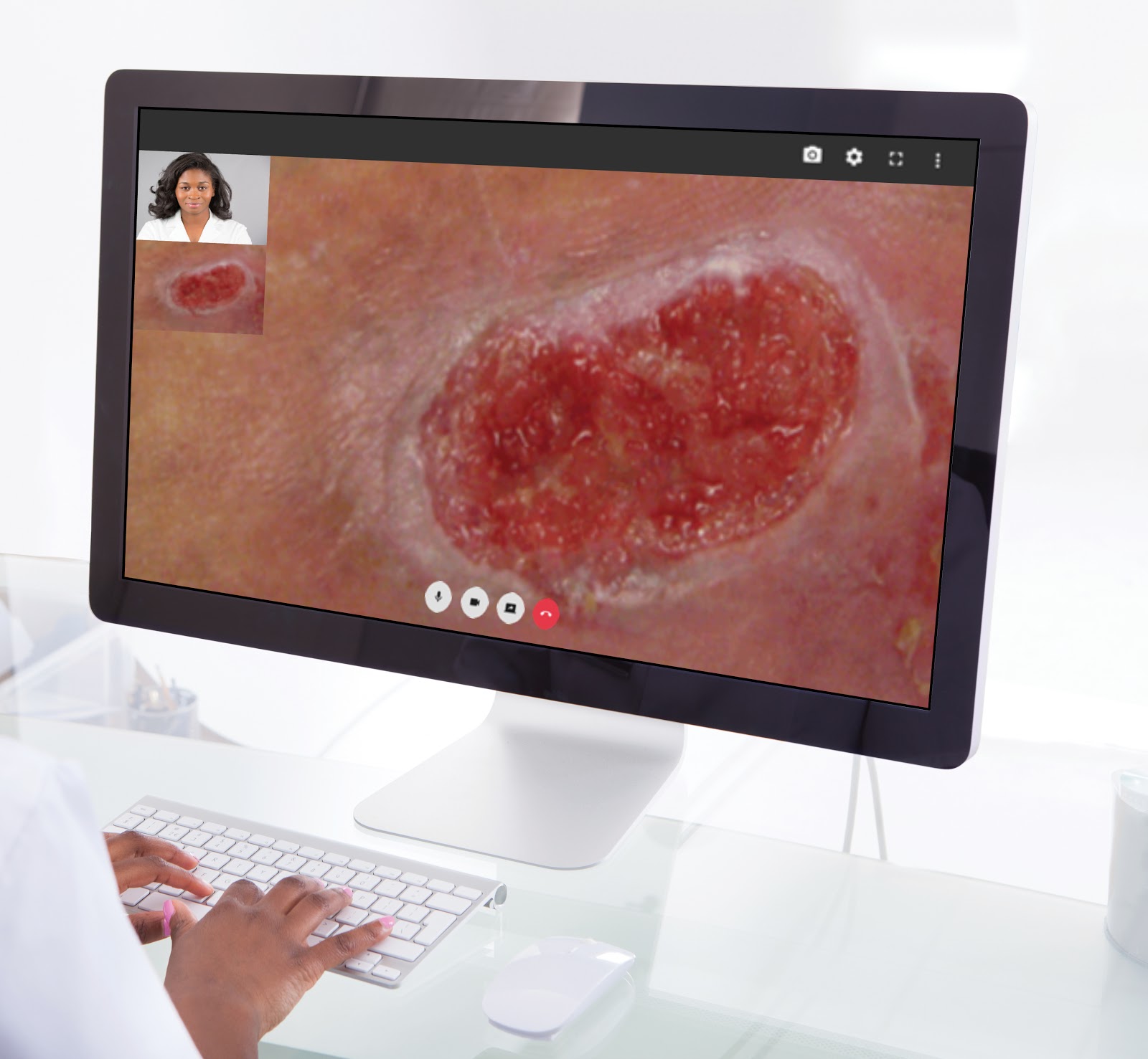 Wound Care Telehealth, Consult and Assessment